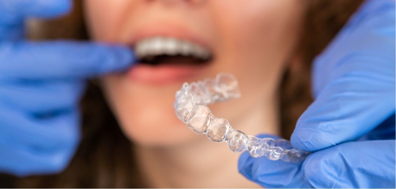 tratamiento invisalign Zoco Rivas