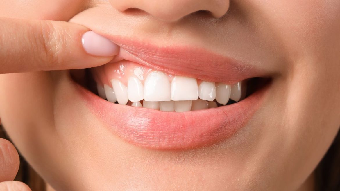 La periodontitis, es una enfermedad que afecta al tejido de las encías, si no se trata a tiempo puede ser peligrosa.