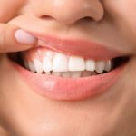 La periodontitis, es una enfermedad que afecta al tejido de las encías, si no se trata a tiempo puede ser peligrosa.